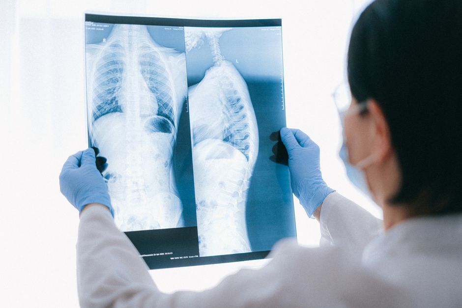 Mobile CT scanner brings lung cancer screening to remote NT communities